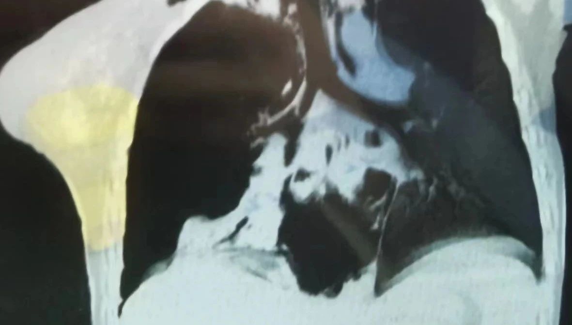 9b274309031b098cac65f3d37bac2118.jpg 9b274309031b098cac65f3d37bac2118.jpg